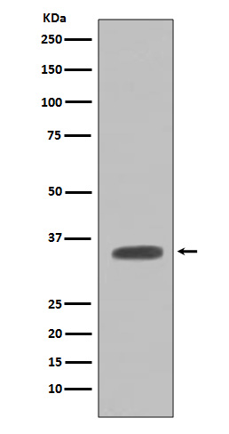 Caspase-7 Rabbit mAb