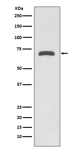 MMP8 Rabbit mAb