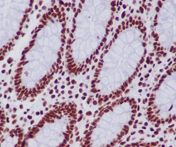 Histone H2B (acetyl K20) Rabbit mAb