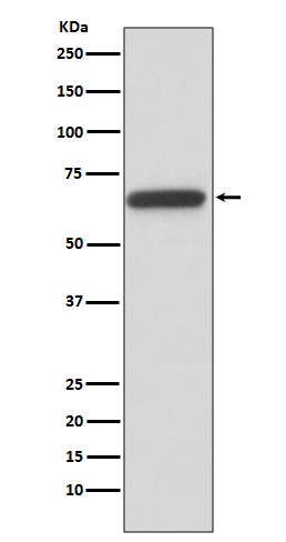 HNF1 beta Rabbit mAb