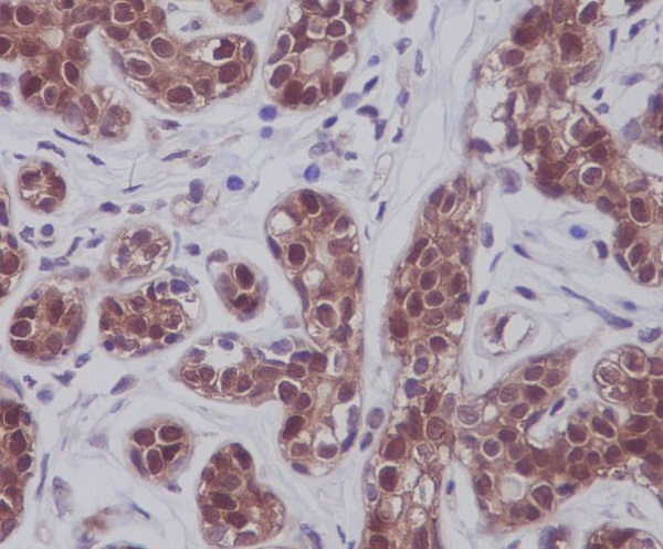 STAT5A/B Rabbit mAb