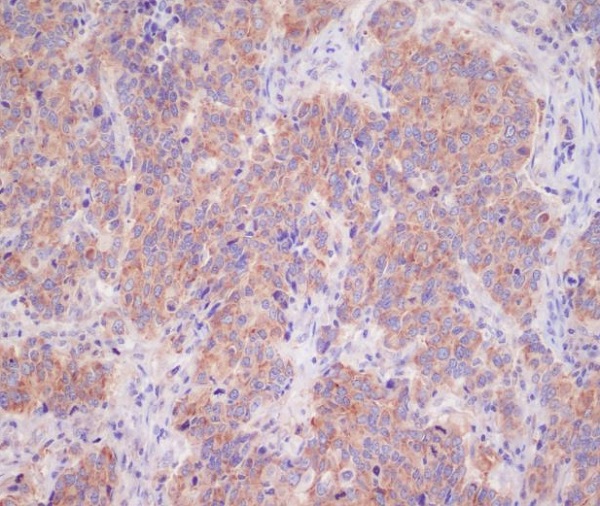 14-3-3 Rabbit mAb