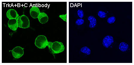 TrkA+B+C Rabbit mAb