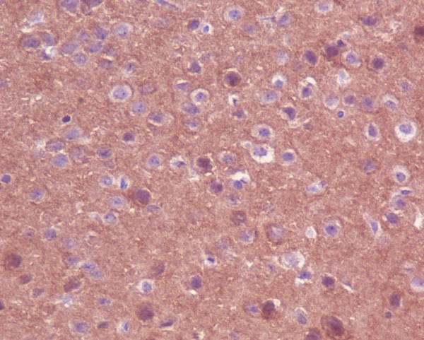 TrkA+B+C Rabbit mAb