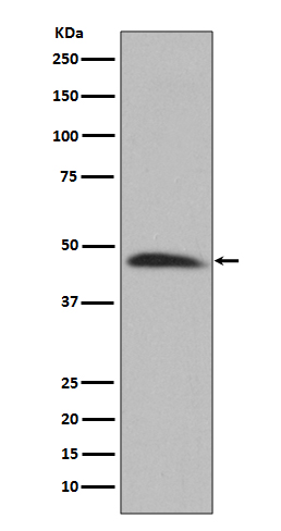 Hsp47 Rabbit mAb