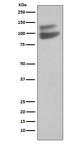 VE Cadherin Rabbit mAb