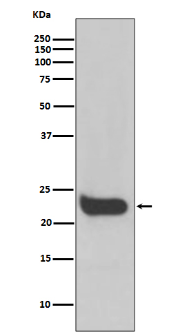 Interferon beta Rabbit mAb