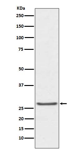 TIMP1 Rabbit mAb