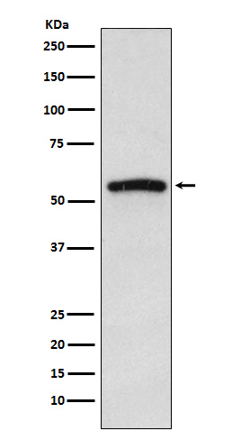 IRAK4 Rabbit mAb