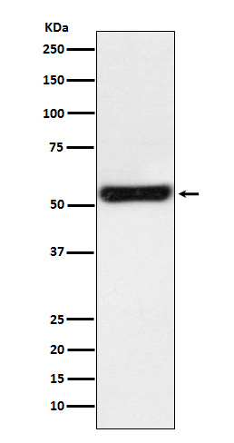 PTGER2 Rabbit mAb