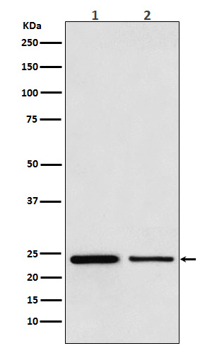 TBPL1 Rabbit mAb