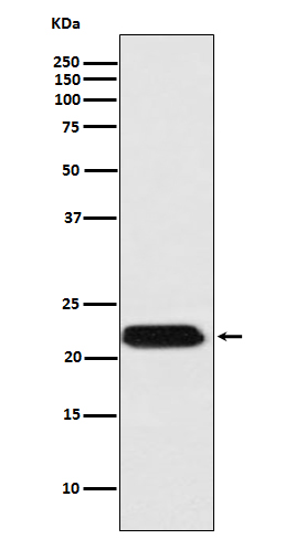 FTMT Rabbit mAb