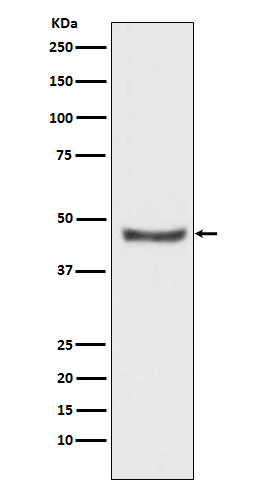 PHD2 / prolyl hydroxylase Rabbit mAb