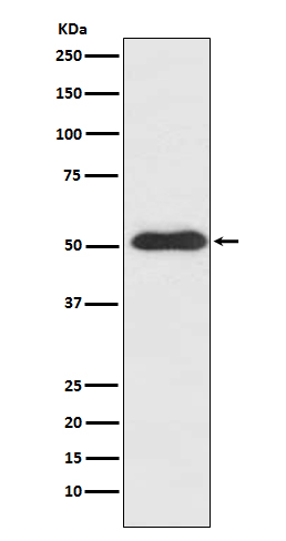 Slit2 Rabbit mAb