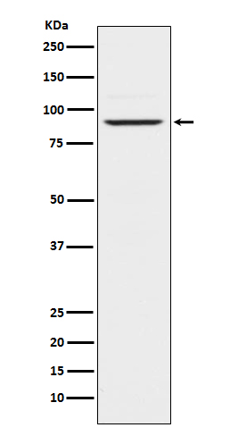 Prolactin Receptor Rabbit mAb