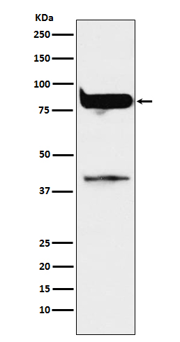 PKC eta Rabbit mAb