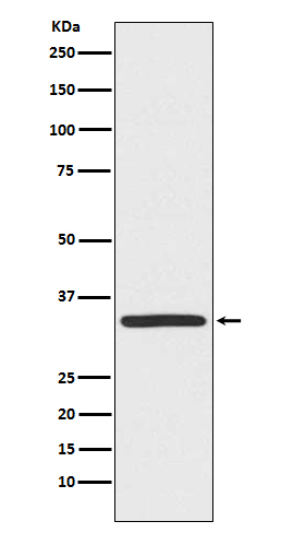 TRADD Rabbit mAb 