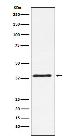 CTLA4 (CD152) Rabbit mAb 