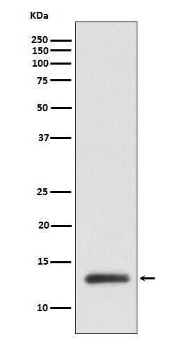 ROC1 Rabbit mAb 