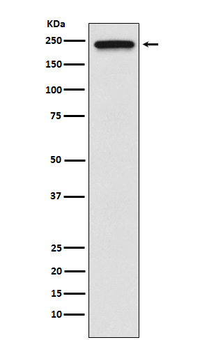 TRPM7 Rabbit mAb