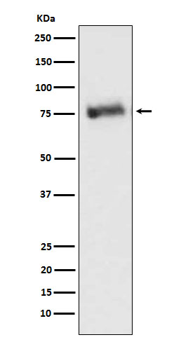 GRK3 Rabbit mAb