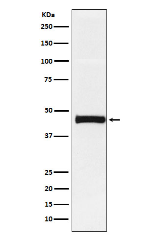 Pentraxin 3 Rabbit mAb