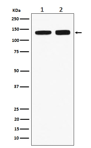 RNF40 Rabbit mAb