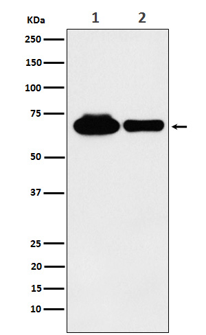 METTL3 Rabbit mAb