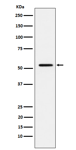 MMP1 Rabbit mAb