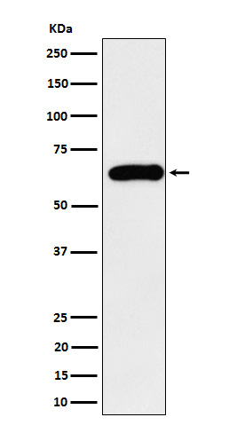 SQSTM1 / p62 Rabbit mAb