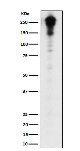 Desmoplakin Rabbit mAb