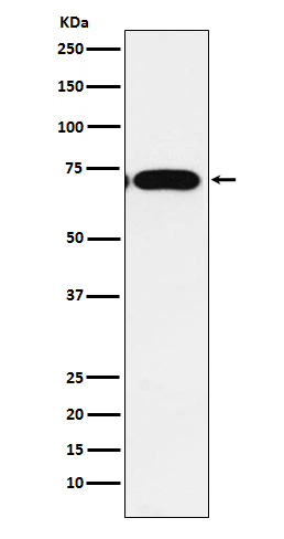 CPEB1 Rabbit mAb