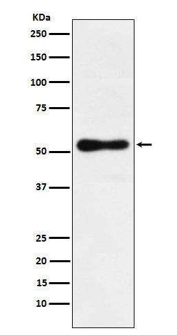 ROR beta Rabbit mAb