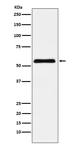 CBX2 Rabbit mAb