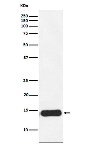 CRABP1 Rabbit mAb