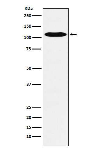 GPCR / LGR6 Rabbit mAb