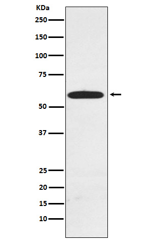 RAD23A Rabbit mAb