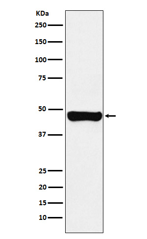 RCC1 Rabbit mAb