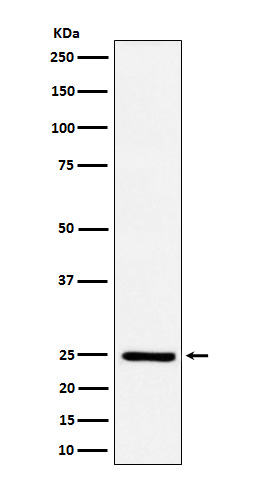 Ephrin A1 Rabbit mAb