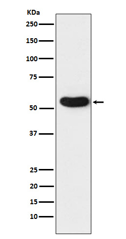 CHRNA5 Rabbit mAb