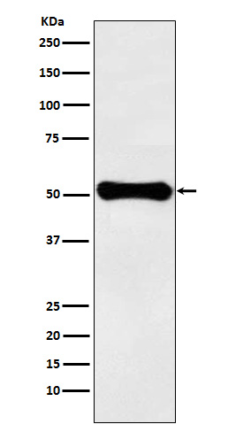 GLUD1 Rabbit mAb