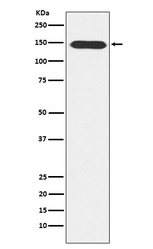 PLCB3 Rabbit mAb