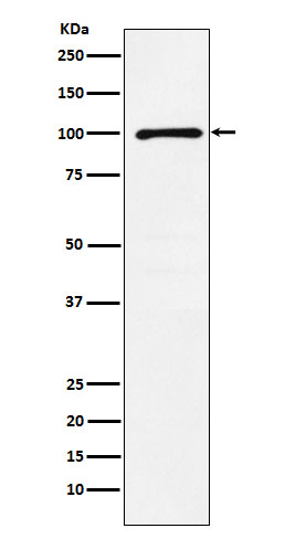 GRIK2 Rabbit mAb