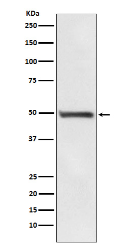 RAD52 Rabbit mAb