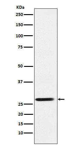 SRD5A2 Rabbit mAb