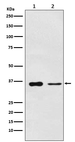 PDLIM1 Rabbit mAb