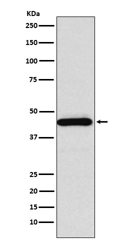 SSTR5 Rabbit mAb