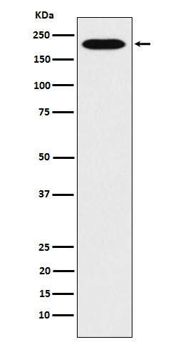 RhoGAP Rabbit mAb