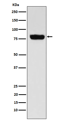 SLC22A3 Rabbit mAb