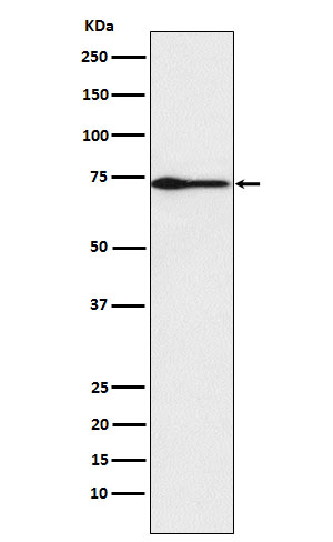 PROS1 Rabbit mAb